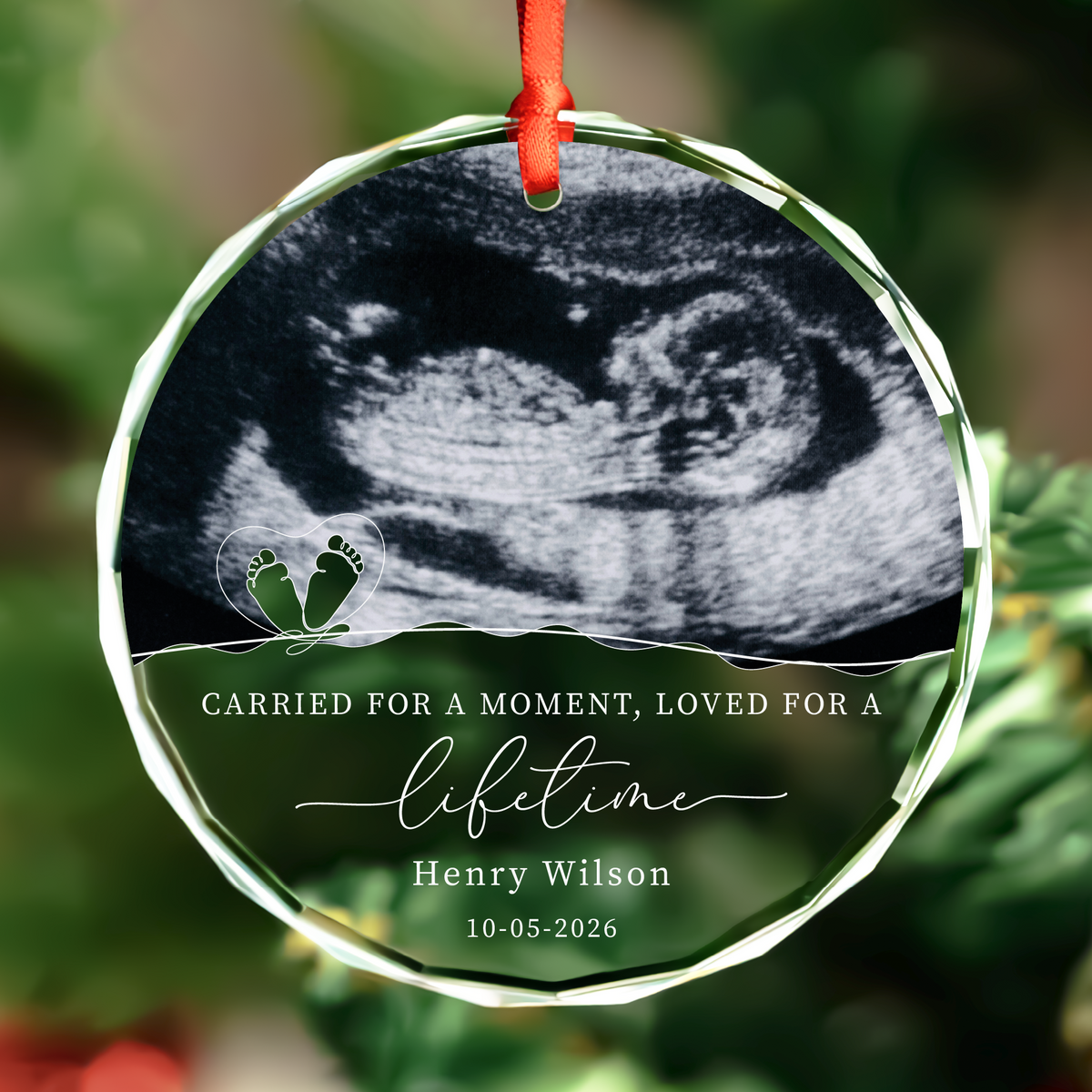 Ultrasound Baby Memorial Ornament
